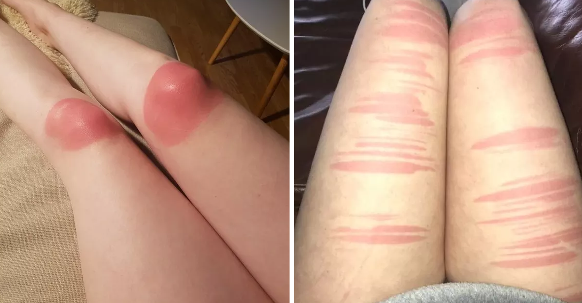 17 chicas que aprendieron de la forma más vergonzosa posible nunca usar  pantalones rasgados al sol | Upsocl
