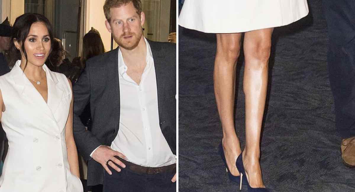 Qué feas y flacas tiene las piernas”: atacan cruelmente a Meghan Markle por  usar vestido corto | Upsocl