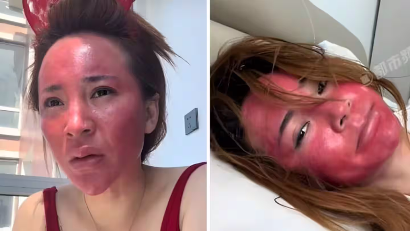 Woman Reveals Horrifying Consequences After Never Fully Removing Makeup For 22 Years